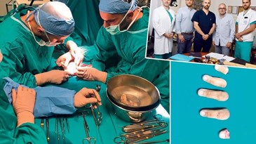 Vrhunski tim kirurga s Rebra pacijentu na ruku vratio sve prste koje mu je odrezala kosilica